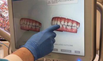 scanner-dental