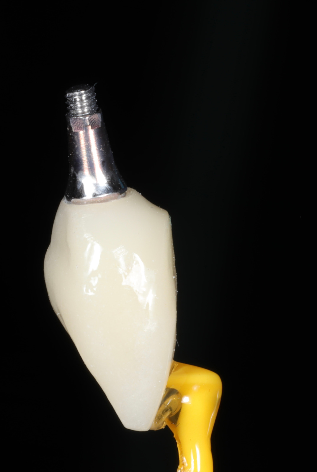 Implantes dentales en Quito: solución segura y duradera para recuperar tu sonrisa